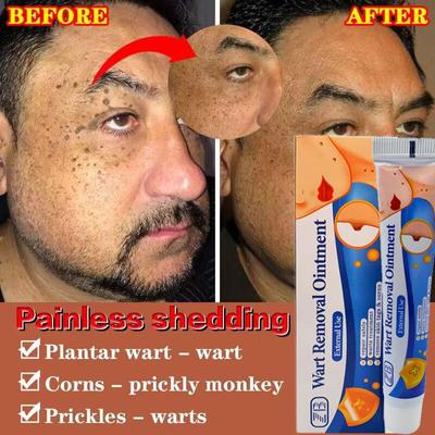 Mısır ve Ben Tüy Dökücü Krem