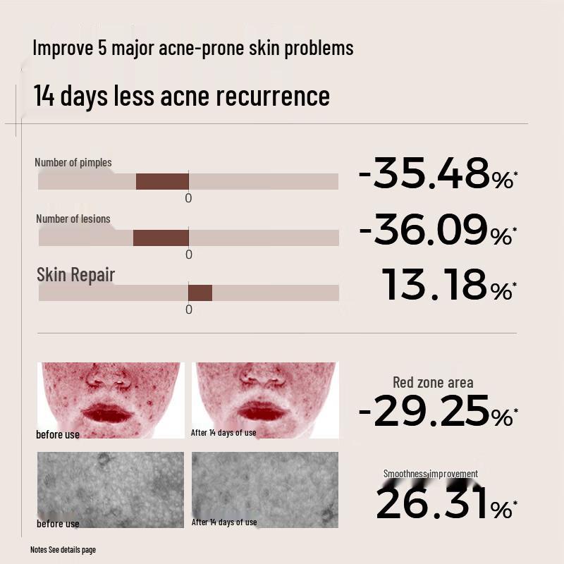 C-cure Acne Clarifying Toner