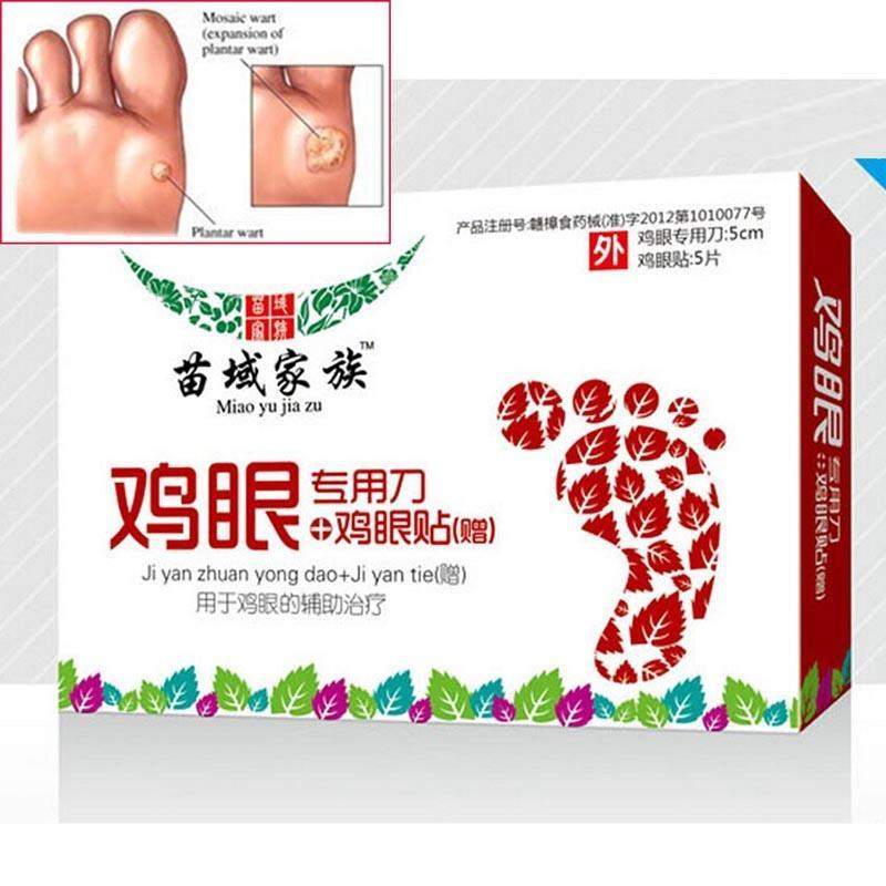 Mosaic Plantar Callus On Foot Stages Of Verruca Early To Dying Phases Explained