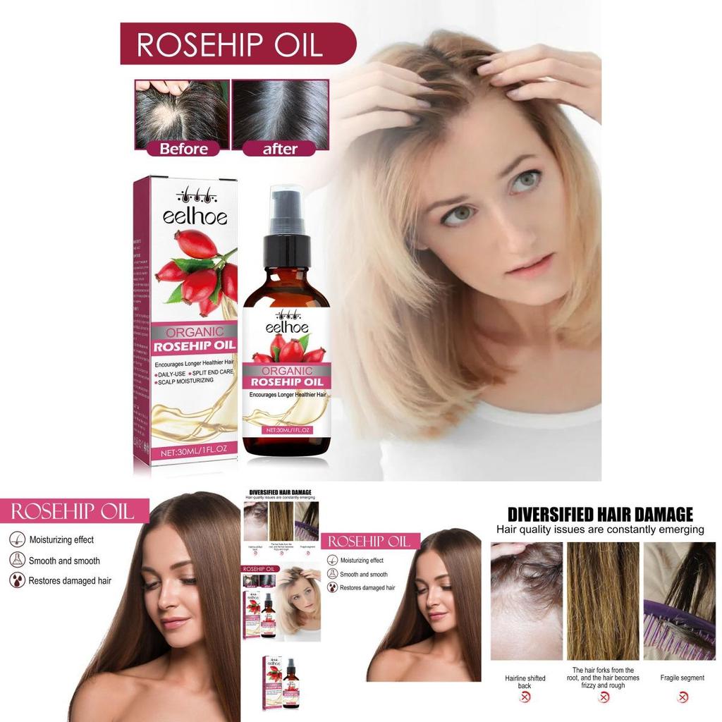 Eelhoe Nourishing Rosehip Oil For Hair Moisturizing And Strengthening 30ml Bottle