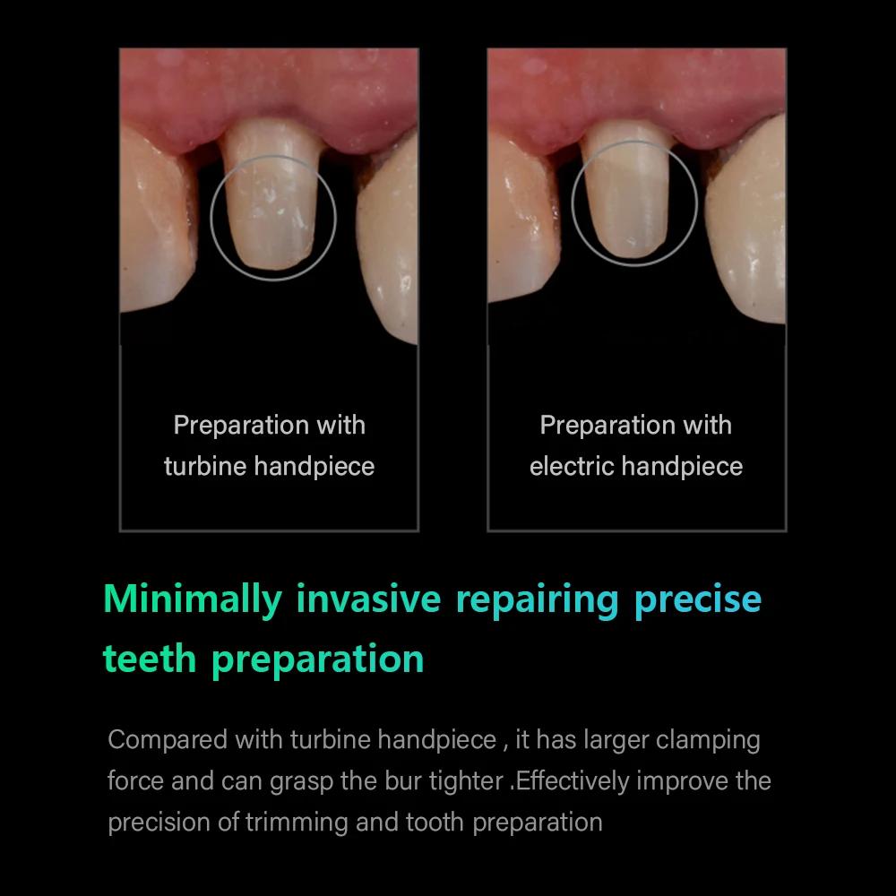 WOODPECKER MT2 Low Speed Dental Electric Motor Imported German Bearing Minimally Invasive Repairing Precise Teeth Preparation