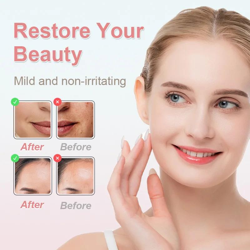 Electric Vacuum Suction Blackhead Remover Facial Pore Cleaner Comedone Spot Acne Pimple Blackhead Extractor USB Rechargeable