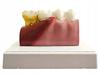 Anatomical Tooth Model (16)