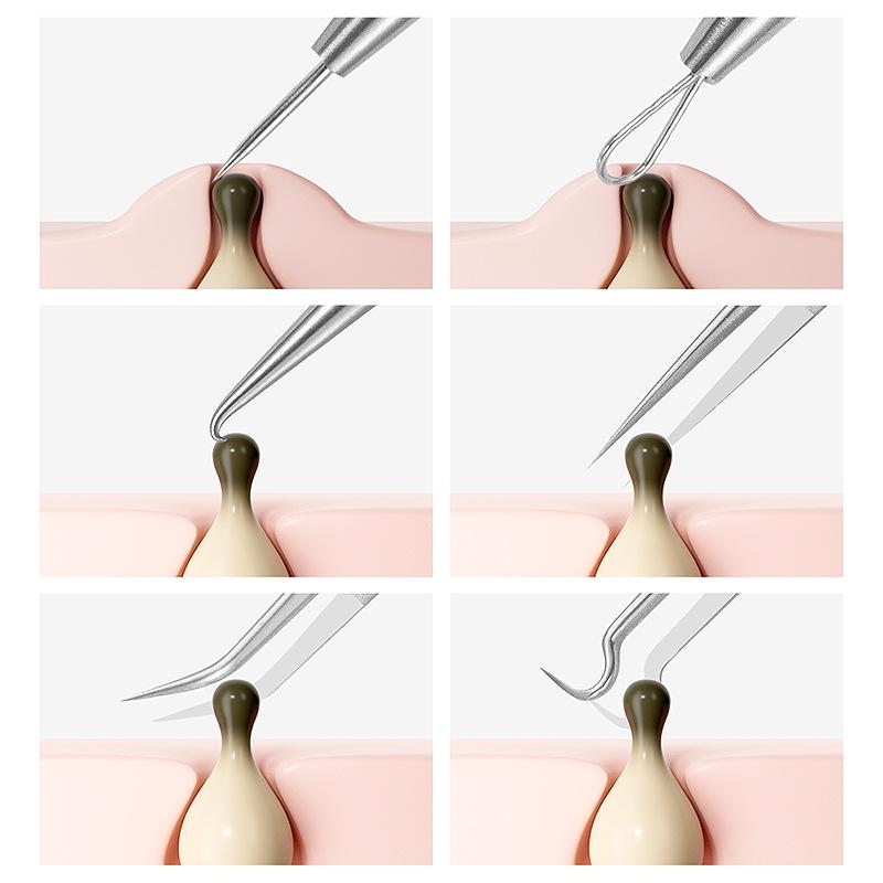 Blackhead Remover & Acne Extractor Tool Set with Tweezers