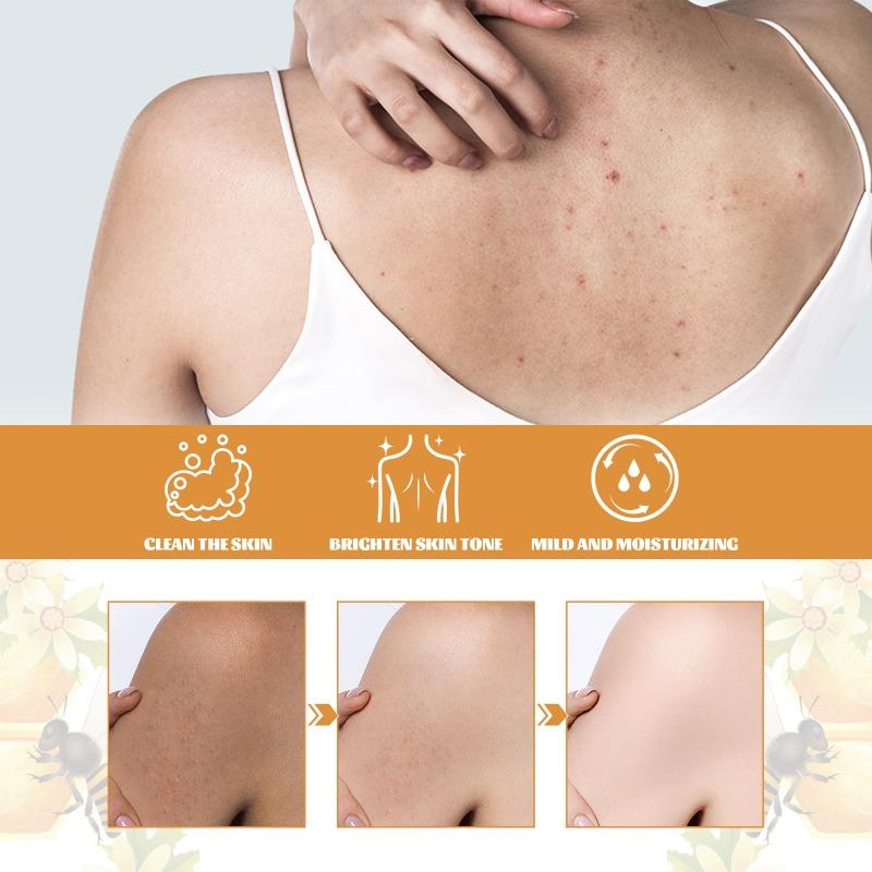 Honig-Duschgel, Tiefenreinigung, Peeling, Feuchtigkeitsspendende Schönheit, straffendes, aufhellendes Duschgel für die Körperhaut