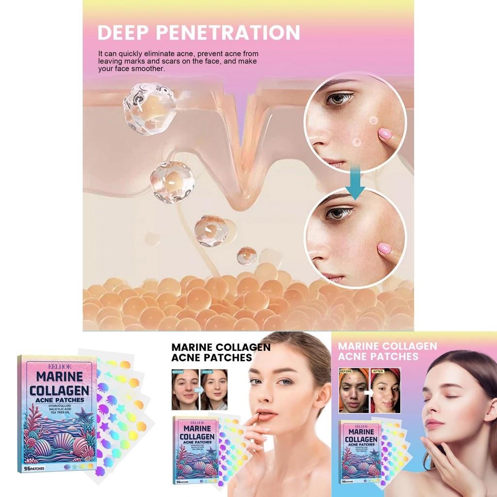 Eelhoe Cute Colorful Acne Patches Convenient Multi-shape Dots For Clear Skin Care