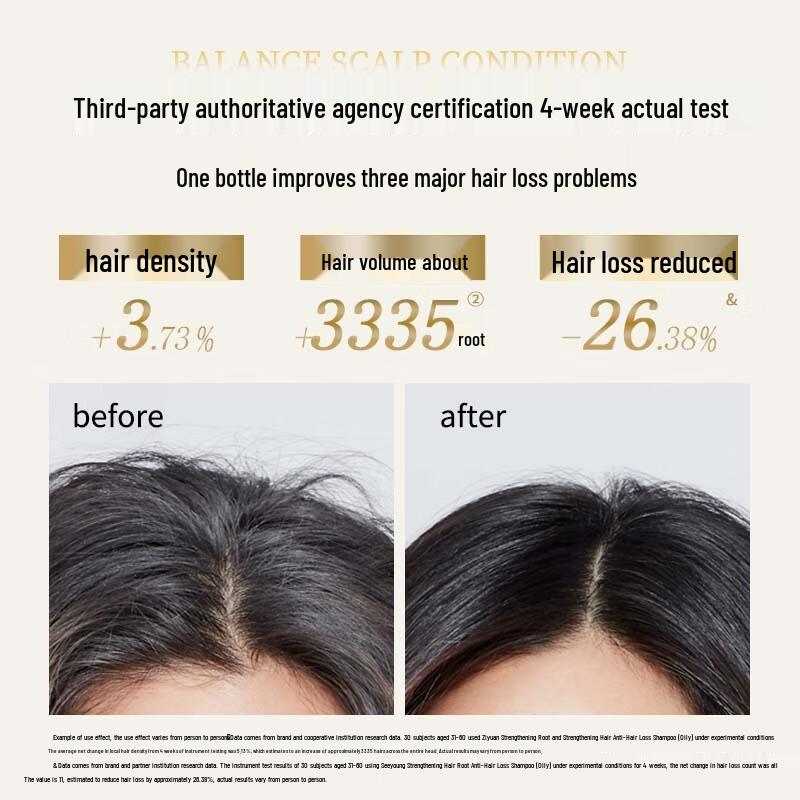 Siyuan Ginger Anti-Hair Loss Shampoo