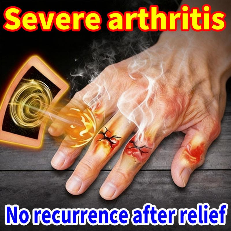 Organic Arthritis Joint Ointment - Freelancers' Home Office Neck Arthritis Protection (Fast-Acting)