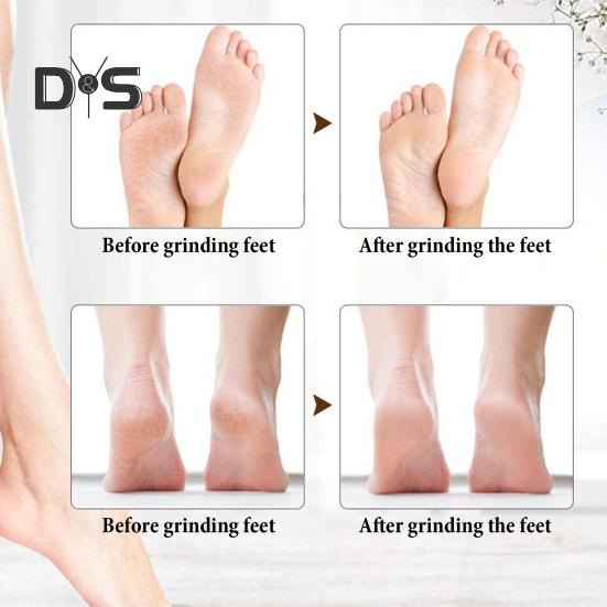 Electric Callus Remover 2-Speed Foot File for Dead Skin Hard & Cracked Heels Portable Pedicure Tool with 360 Degrees Roller Heads