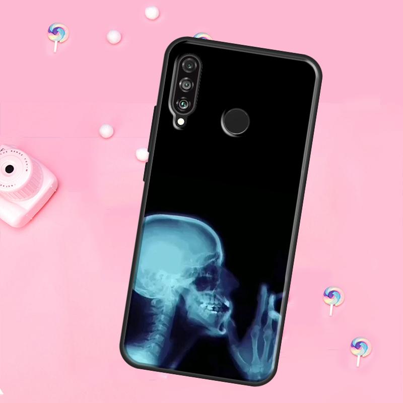xray art aesthetic Skull For Huawei Nova 10 9 SE 3i 7i 8i 11i 12i Y73 Y90 Y70 Y72 Y61 Y91 P60 Pro P30 P40 Lite Case
