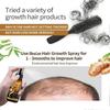 Biotin hair growth spray anti hair loss fast regeneration scalp treatment essence