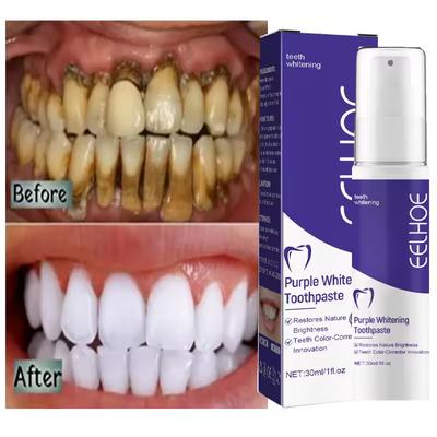 Dentifricio sbiancante per denti, siero, rimozione della placca, macchie, igiene orale, pulizia, sbiancamento dentale, strumenti, alito fresco, cura dei denti