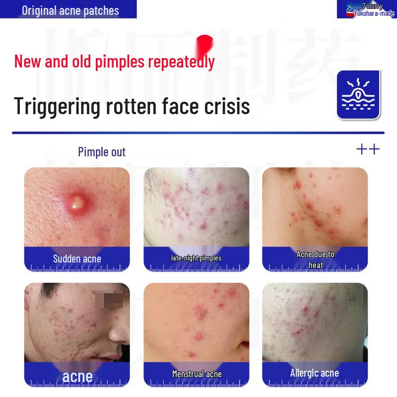 Медицинские невидимые пластыри от прыщей Макихара