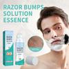 Ingrown Hair Care Ball Bump Care For Bikini Area Jade Care,Specially Designed For Delicate Areas,Offering Targeted Relief From Shaving Bumps 100ML