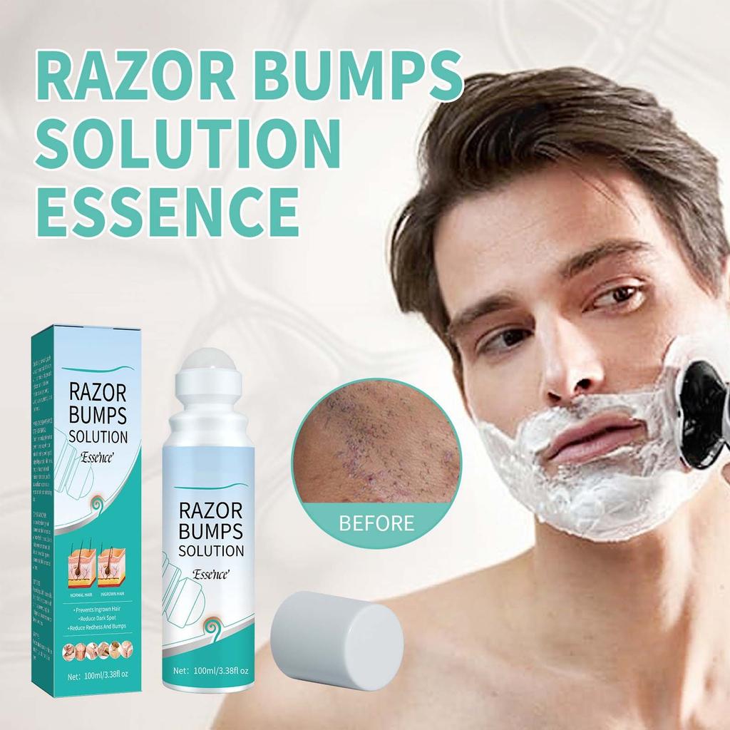 Ingrown Hair Care Ball Bump Care For Bikini Area Jade Care,Specially Designed For Delicate Areas,Offering Targeted Relief From Shaving Bumps 100ML