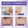 B3 Serum, Dark Spot Corrector B3 Serum With Anti-Aging 10% Niacinamide Discoloration Correcting Serum for Sun Spots, Age Spots & Post-Acne Marks