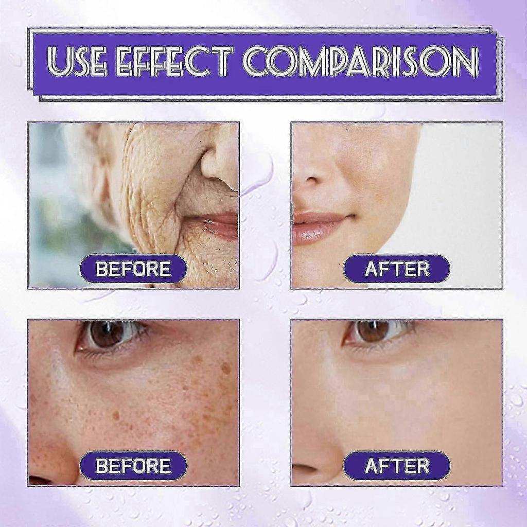 B3 Serum, Dark Spot Corrector B3 Serum With Anti-Aging 10% Niacinamide Discoloration Correcting Serum for Sun Spots, Age Spots & Post-Acne Marks