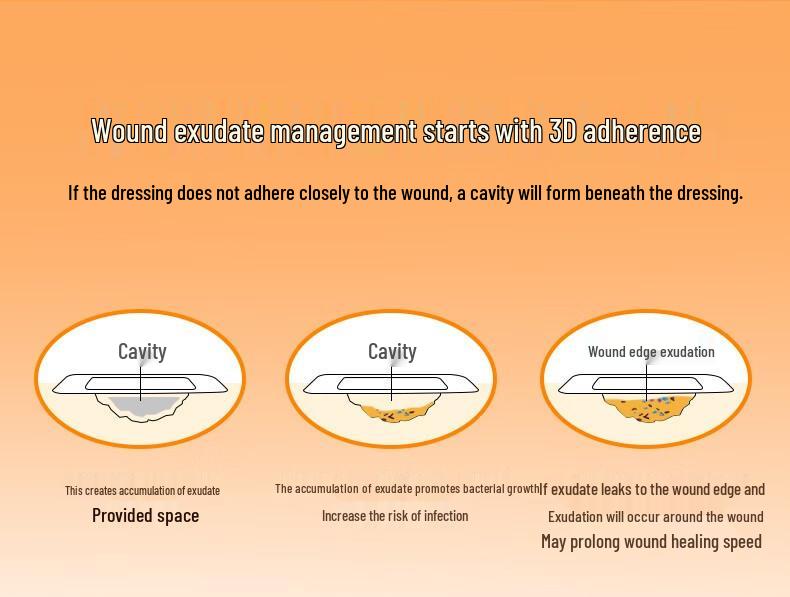 Hydrogel-Pad zur Prävention von Druckgeschwüren bei älteren Menschen – Saugfähiges medizinisches Schaumstoff-Verbandmaterial.