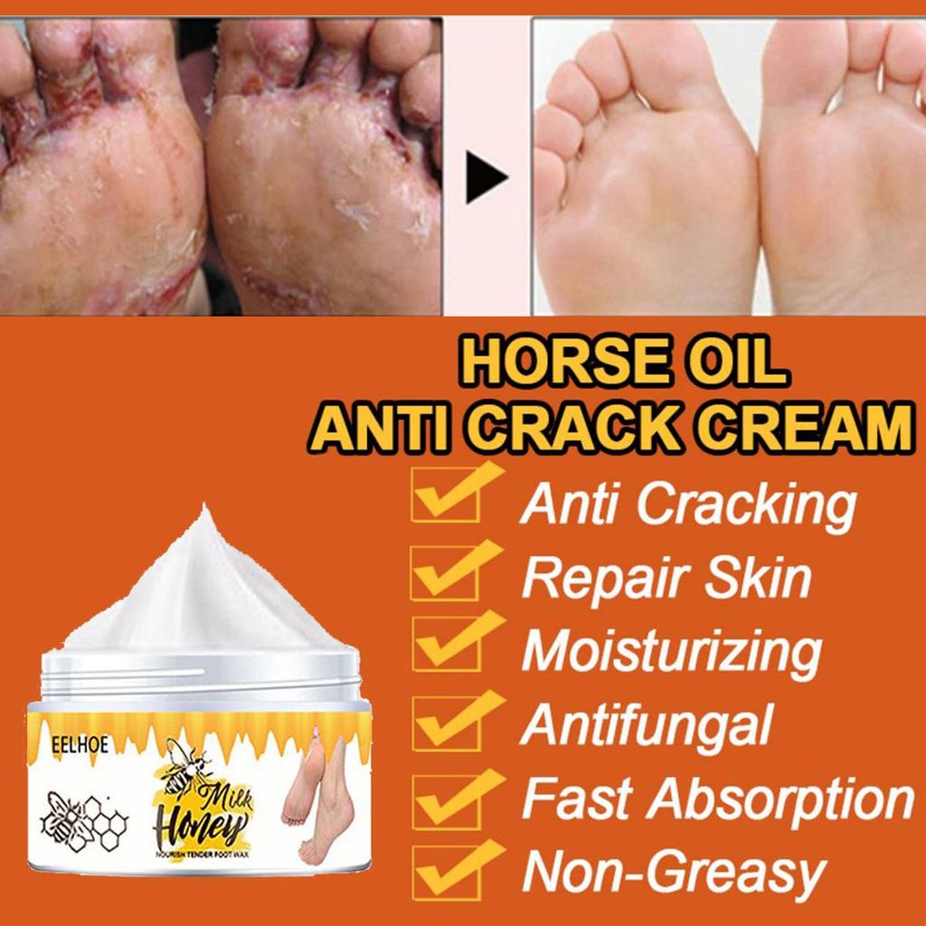 Sprukne hender og føtter reparerer krem, fukter, gir næring til huden og etterlater huden myk og delikat