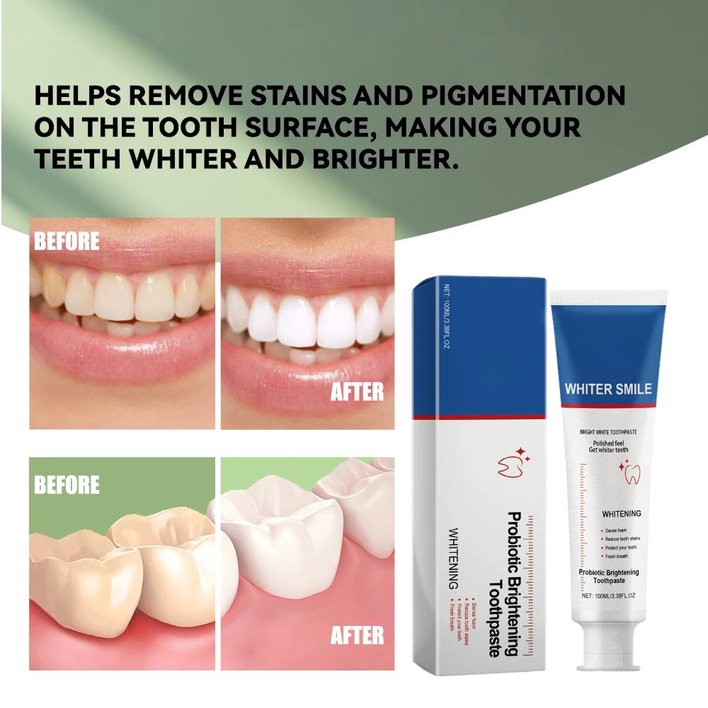 Dentifrice Probiotique Blanchissant 100ml Hygiène Bucco-Dentaire Haleine Fraîche Élimination des Taches Nettoie Dents Jaunes Blanchit les Dents Dentifrice