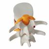 Genuine Lumbar Spine Protrusion & Vertebra Pathology Model