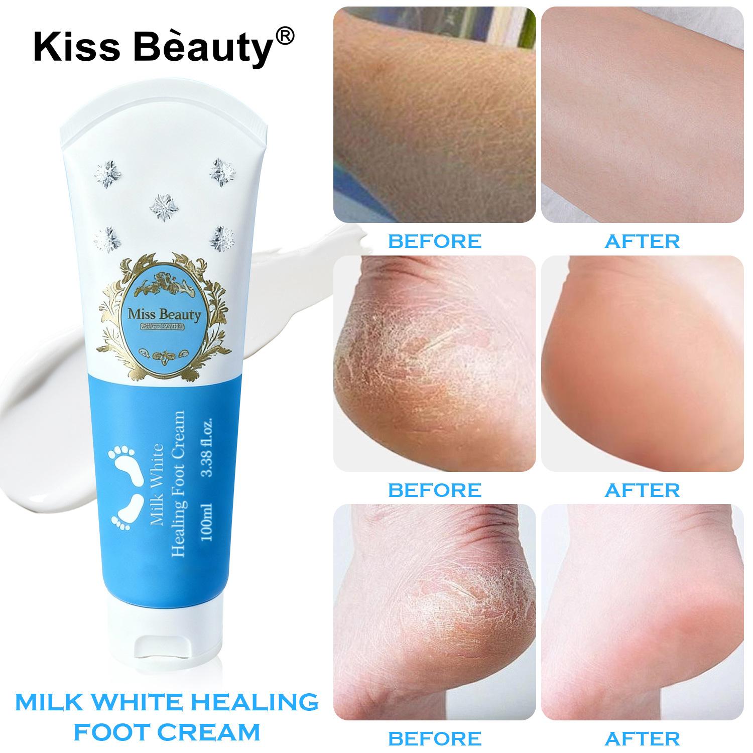 Kissbeauty Anti-Dry and Cracked Foot Cream Hand and Foot Care Moisturizing and Moisturizing Foot Care Cream 100ml