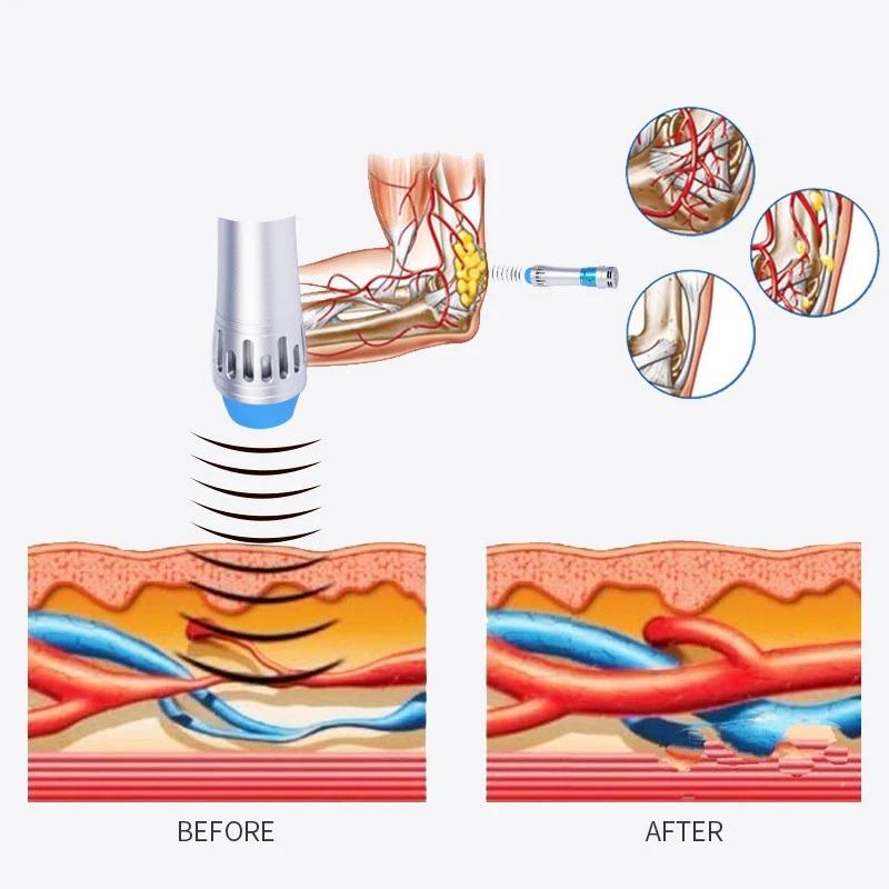 Muscle Massager Shockwave Machine 7 Heads Lattice Ballistic Shock Wave Silicone Heads Portable Home Sports Recovery Ergonomic Design