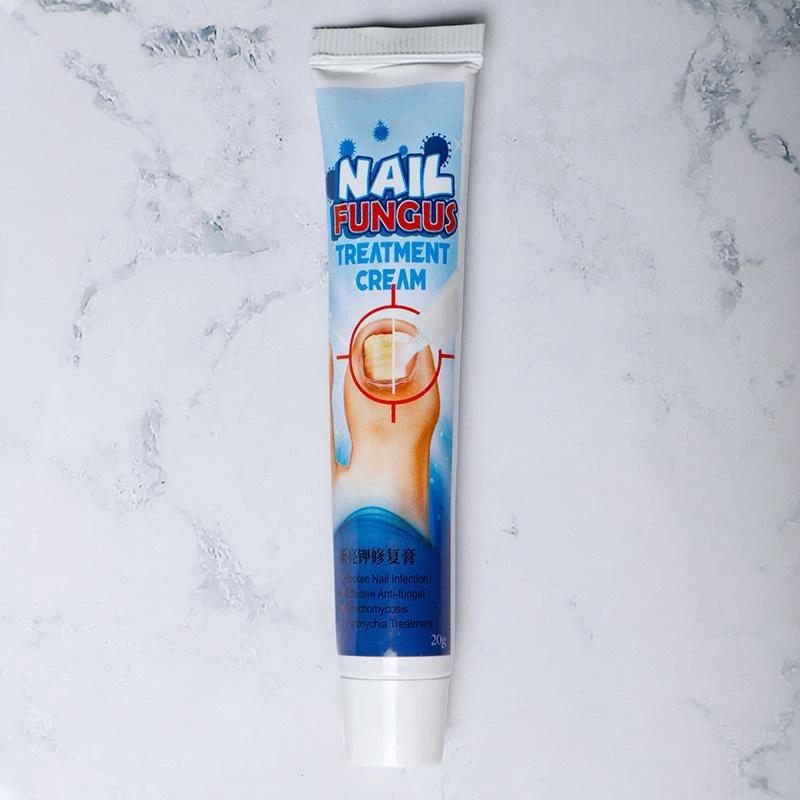 Nail Treatment Cream Antibacterial Repair Ointment Whitening Toe Anti Infection Nail Repair Cream Nail Care