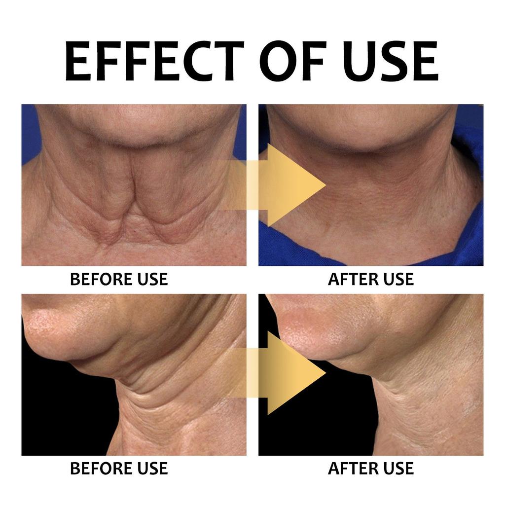 TurmericNeck Firming Cream Facial Moisturizer With Retinol Collagen Hyaluronic Double Chin Reducer Hydrating Face Cream