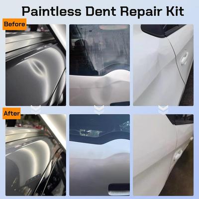 Paintless Dent Repair Kit with Dent Lifter, Bridge Puller, Glue Gun & Tabs – Car Dent Removal Tools for Hail Damage & Door Dings