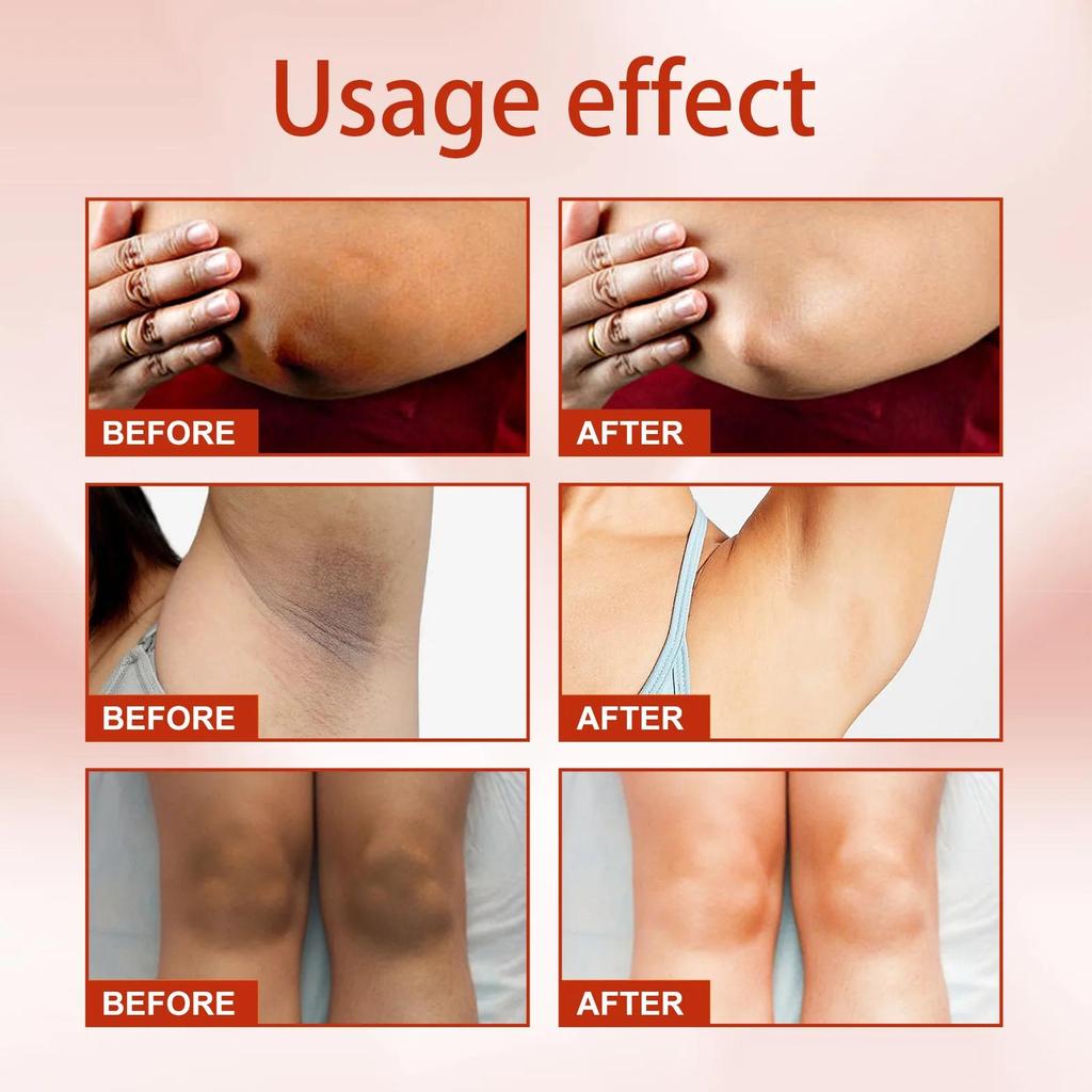 The Skin Cream Moisturizes, Nourishes and Brightens the Skin. Body Lotion To Reduce Skin Dullness and Brighten Skin Cream