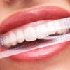Spot 9D Teeth Whitening Stickers - Brighten Yellow Teeth, 1pc Hot Sale