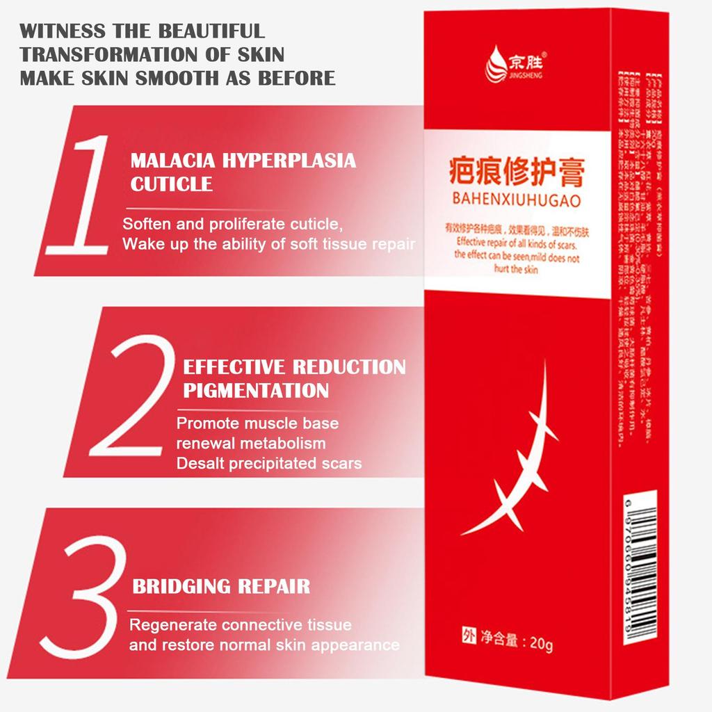 20 г крем для удаления шрамов от акне, хирургическое удаление растяжек, гель для кожи лица, отбеливающий пигментацию тела, Sm U4P9