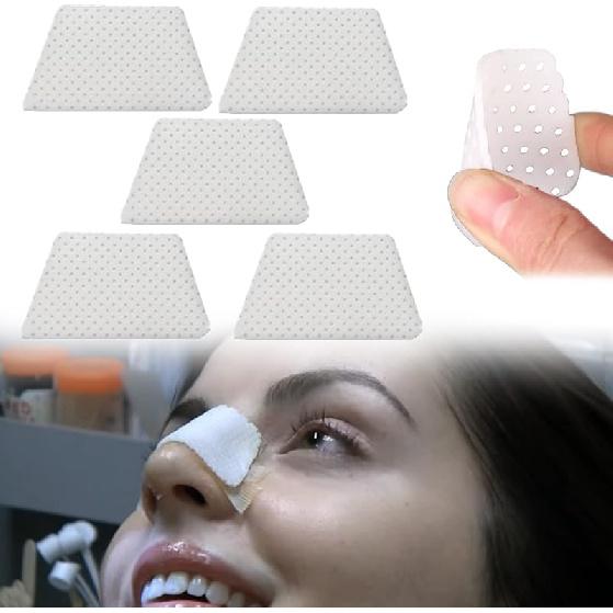 Mediss Thermoplastic Nasal Splints, External Nose Support Protector for Rhinoplasty Septoplasty Surgery, Nose Brace Fracture, ENT, Orthopedic