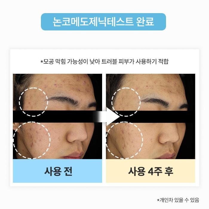 HEYNATURE Houttuynia Cordata Skin Moisturizer Toner 200ml + Heartleaf Mask 2pcs Set