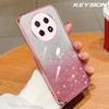 KEYSION Luxury Plating Glitter Phone Case for HONOR X9c 5G Transparent Soft TPU Shockproof Back Cover for Honor Magic 7 Lite 5G