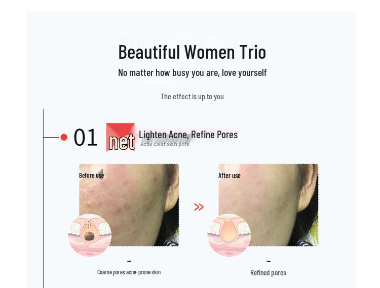 Seven-color LED Beauty Mask for Acne Removal, Whitening, and Rejuvenation with LED Neck Mask