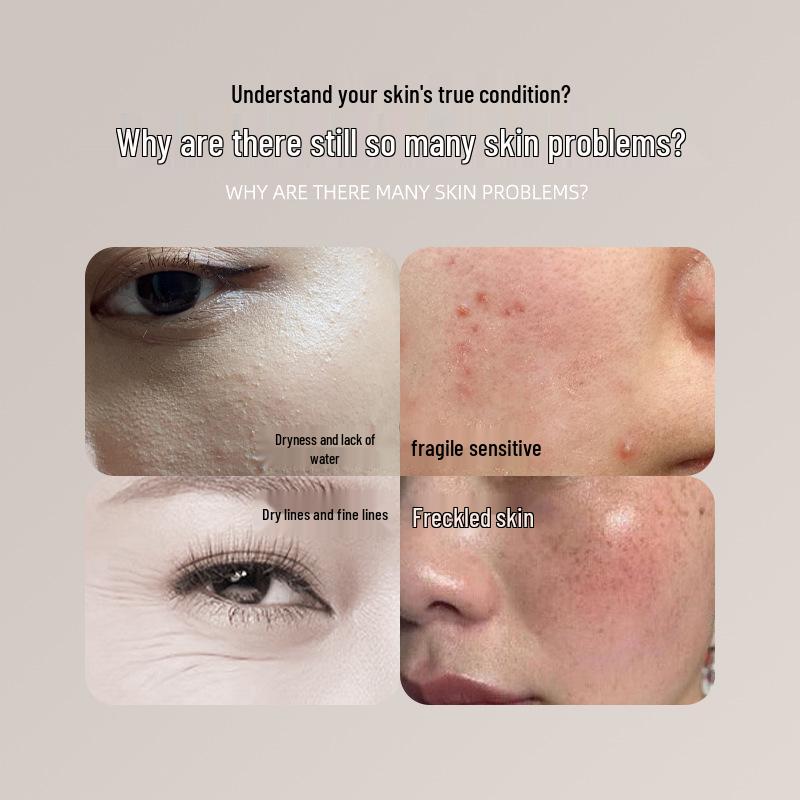 Portable Skin Moisture and Oil Tester - Home Beauty Device