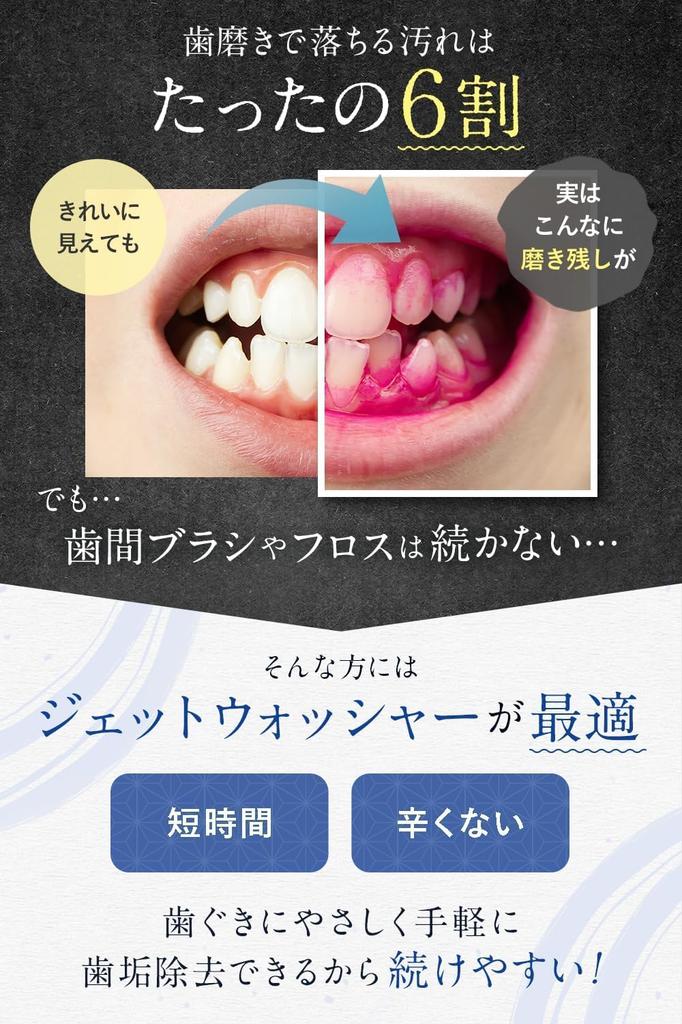 SHIROE Jet Oral Irrigator mit 5 Wasserdruck 350ml und 3 Ersatz-USB IPX7 Interdental- und Jet-Reinigungseinheit Düsen Grün Spülung, Stufen, Tank,