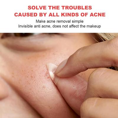 Hydrocolloid Acne Pimple Patch for Covering Zits and Blemishes In Face and Skin - 72/108/144Count