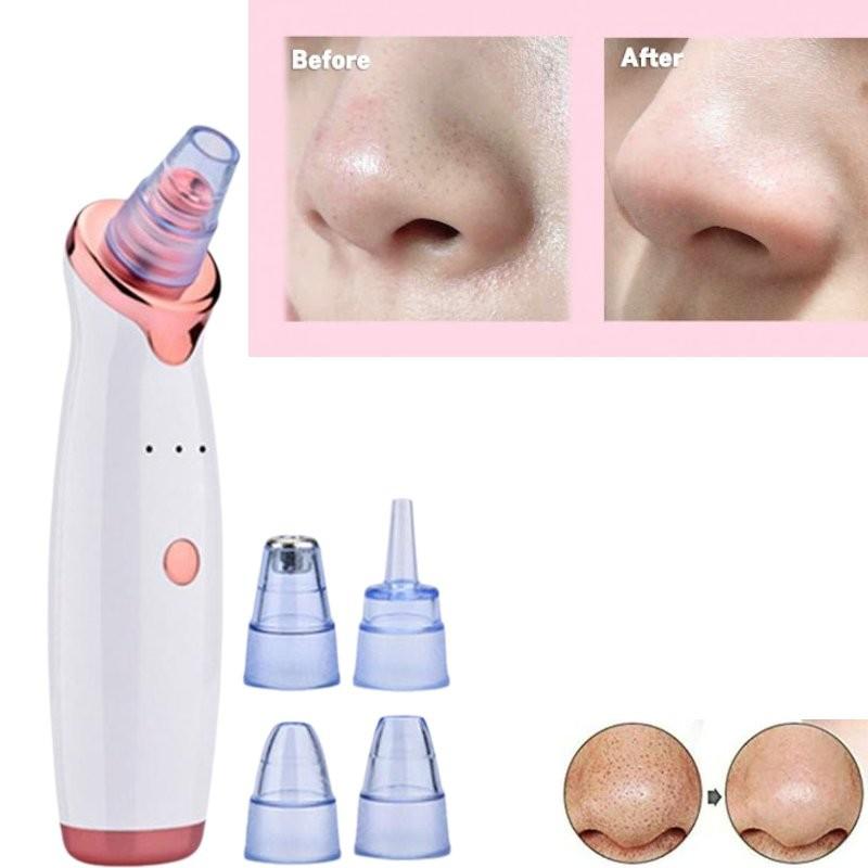 Advanced Electric Blackhead Remover Facial Pore Cleanser With Smart Massage Features