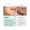 Large Pimple Patches, Acne Patches, Big Hydrocolloid Bandages for Body, Face, Forehead, Chin, Neck Zit Breakouts, Hydrocolloid Patch