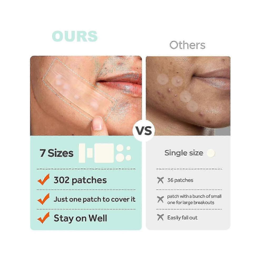 Large Pimple Patches, Acne Patches, Big Hydrocolloid Bandages for Body, Face, Forehead, Chin, Neck Zit Breakouts, Hydrocolloid Patch
