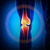Kniebandage für Damen und Herren mit Patella-Gelpolster, Kompressions-Knieschutz für Meniskusriss, Kniebandage zur Schmerzlinderung bei Arthritis-Schmerzen beim Training mit seitlichen Stabilisatoren