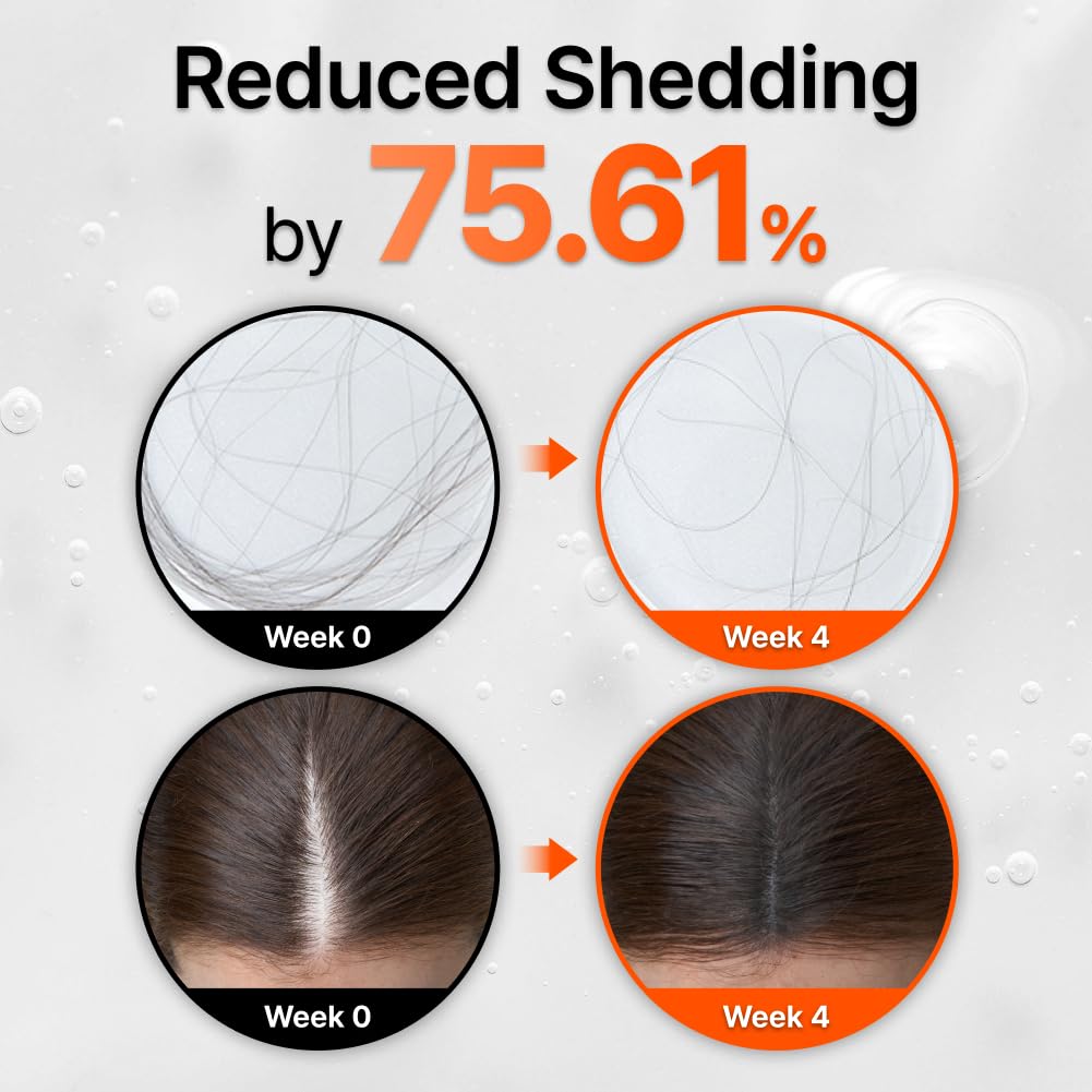 lilyeve Wachsen:TURN Haarausfall Bürstenampulle 100 ml – Kopfhautpflege-Set (+ 100 ml Nachfüllung)