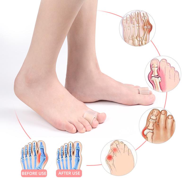 SEBS Toe Spacer: Thumb Valgus & Bunion Relief