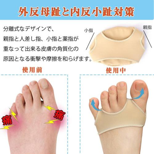 Foot Protection Pads, Metatarsal Pads, Sesamoid Bone Support Support for Plantar Blisters, Corns, and Calluses, Silicone Pads, Shock Absorption, Foot