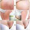 Stretch Mark Cream Pregnant Women Postpartum Stretch Marks  Crema Para Blanquear La Cara Skin Whitening Cream