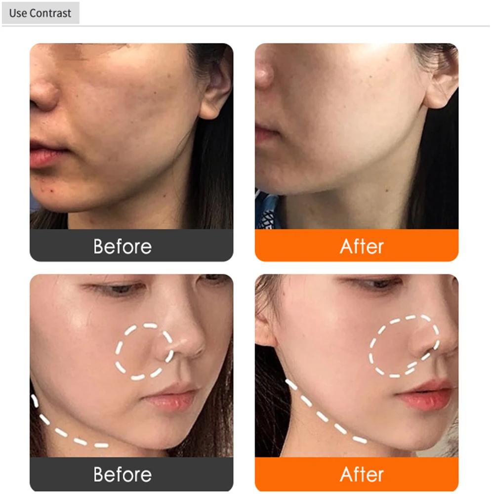 Masaż Odmładzający Twarz Maszyna do Ujędrniania i Liftingu Skóry Redukująca Zmarszczki Wybielająca Cienie pod Oczami