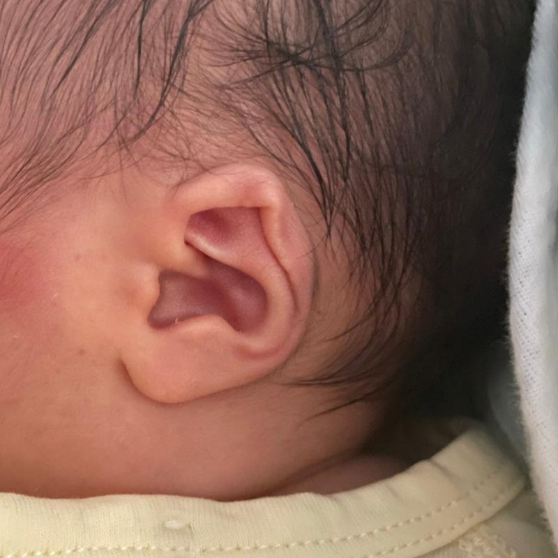 Baby Öronmussla Stöd Yttre Öronmussla Korrigerare Utstående Babyöra Korrigerare Baby Yttre Öronmussla Korrigerare Öronkuddar